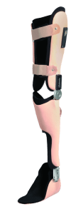 ارتز و پروتز ( orthoses & prostheses )