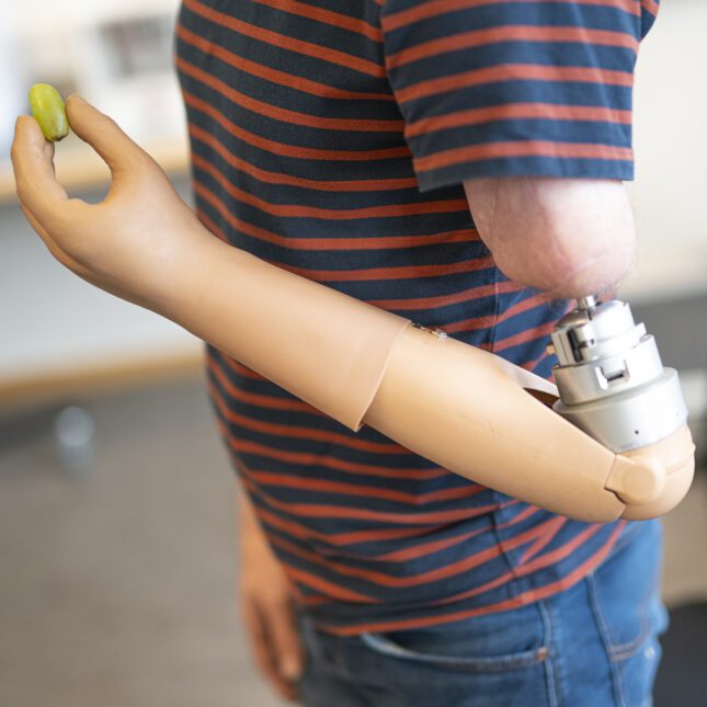 prosthesis-645x645