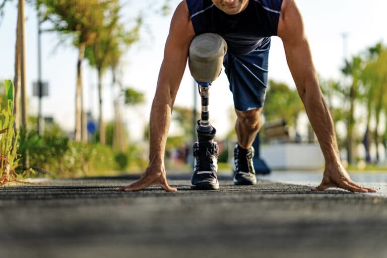 Leg Prosthesis what is