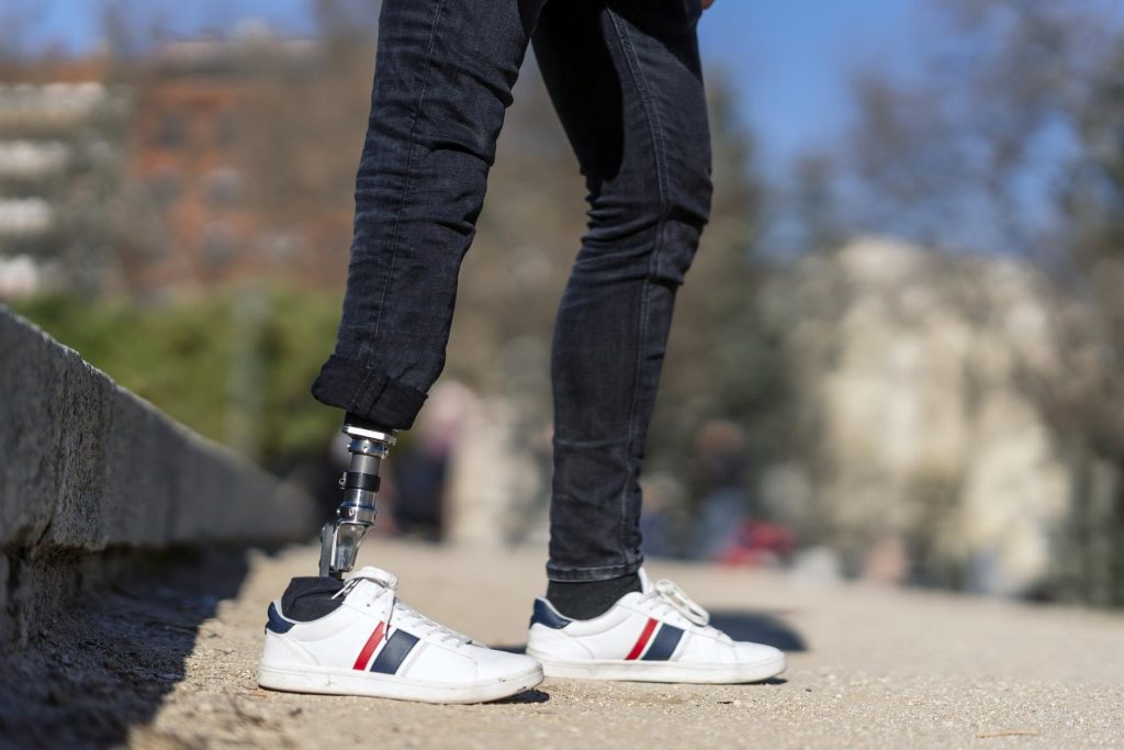 prosthetic leg